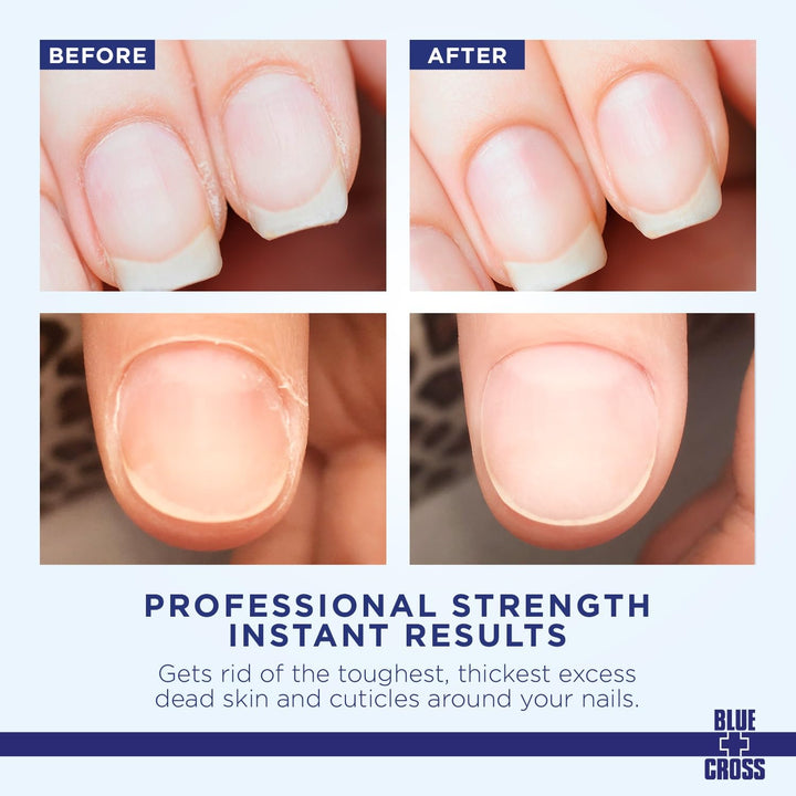 Cuticle Remover & Softener 6oz